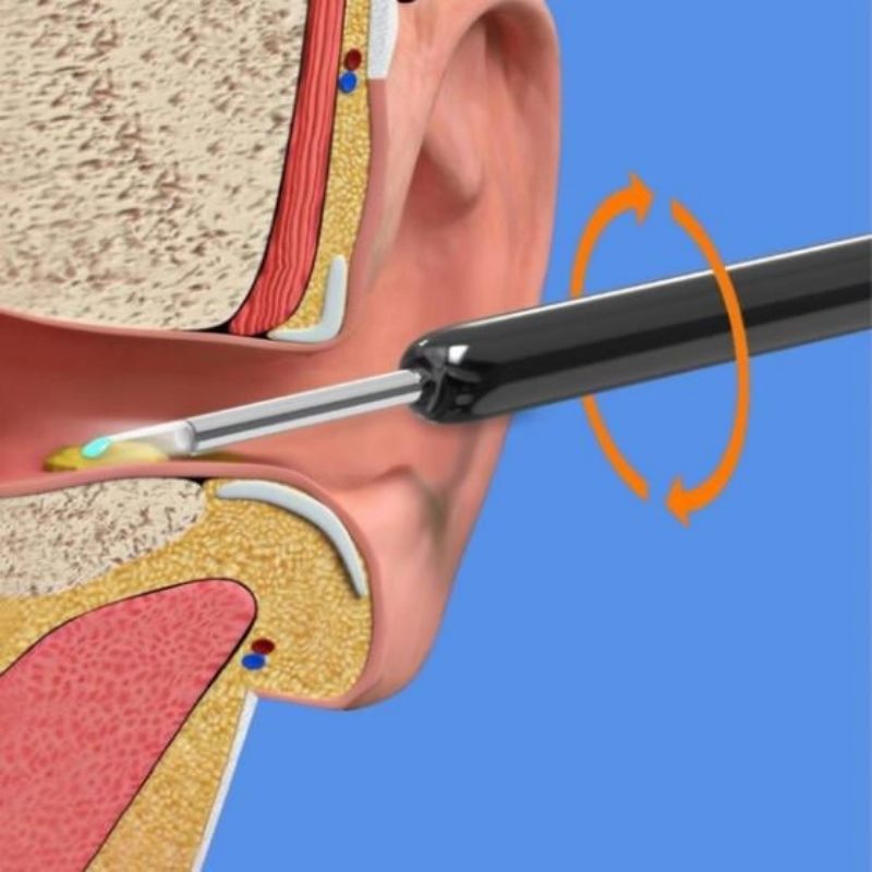 1080p Visual Ear Cleaner | HD Earwax Removal Tool Kit